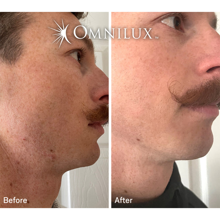 Omnilux Contour Men