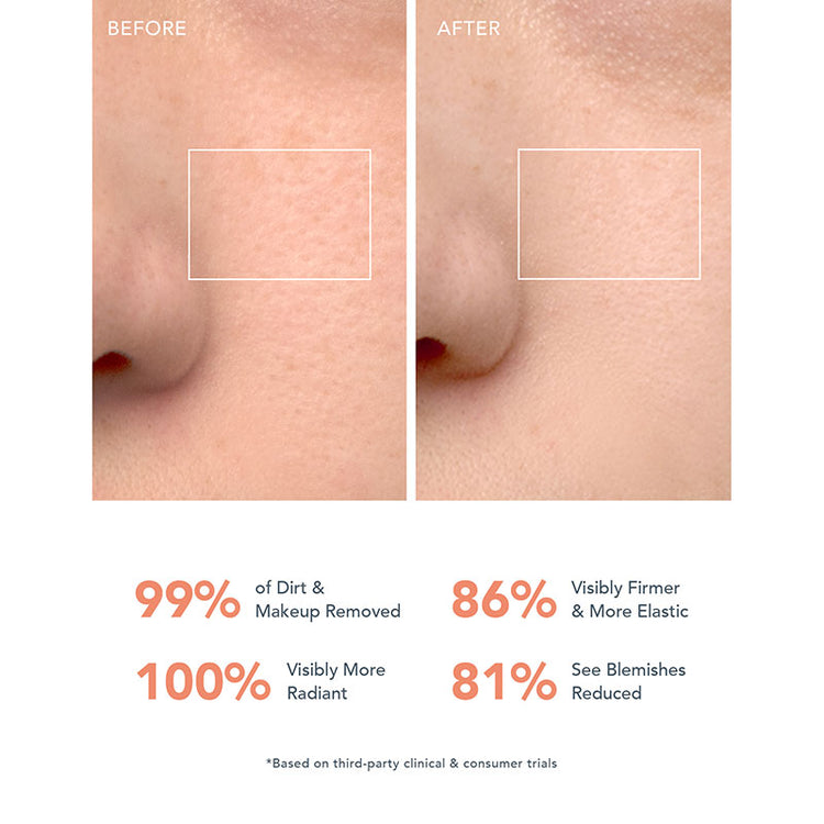 FOREO LUNA 4 Go - Peach Perfect