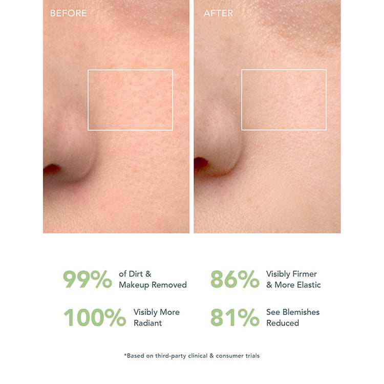 FOREO LUNA 4 Go - Pistachio
