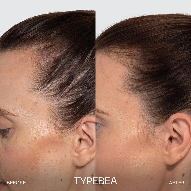 TYPEBEA G1 Overnight Boosting Peptide Serum 10ml
