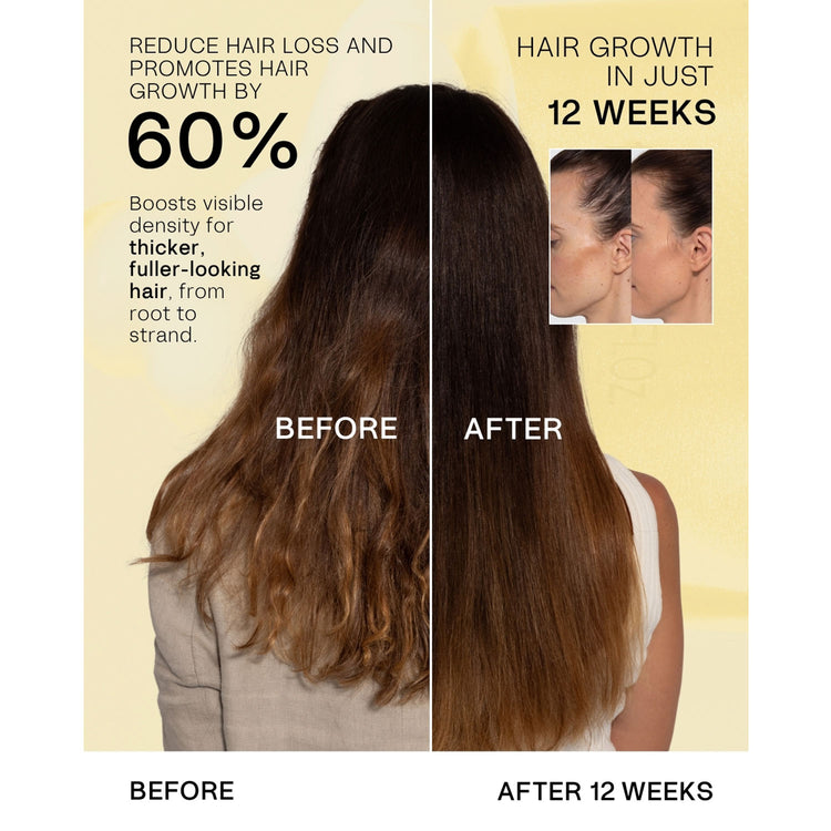 TYPEBEA The Hair Growth & Gloss Kit