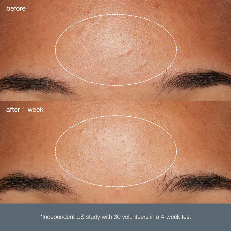 Dermalogica Daily Microfoliant 74g