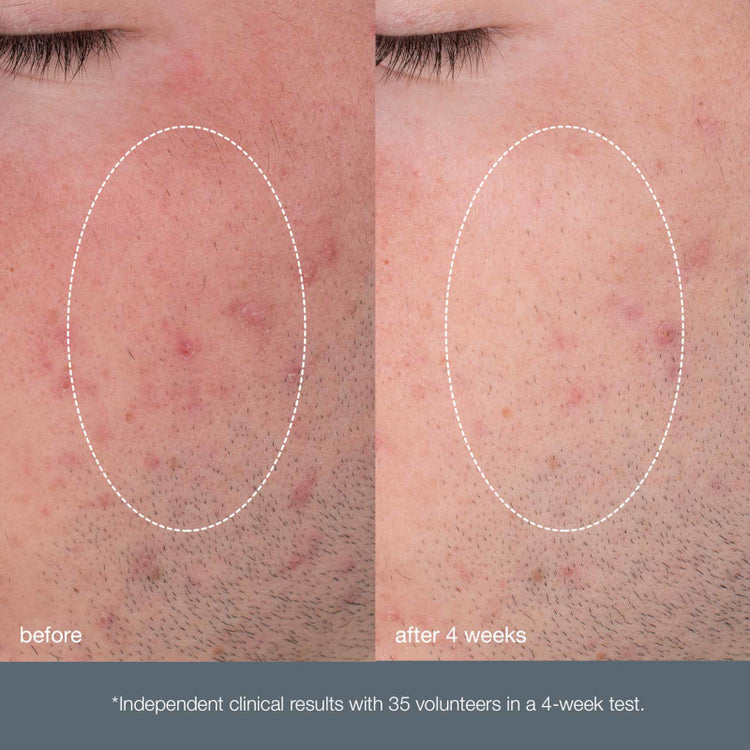 Dermalogica Daily Microfoliant 74g