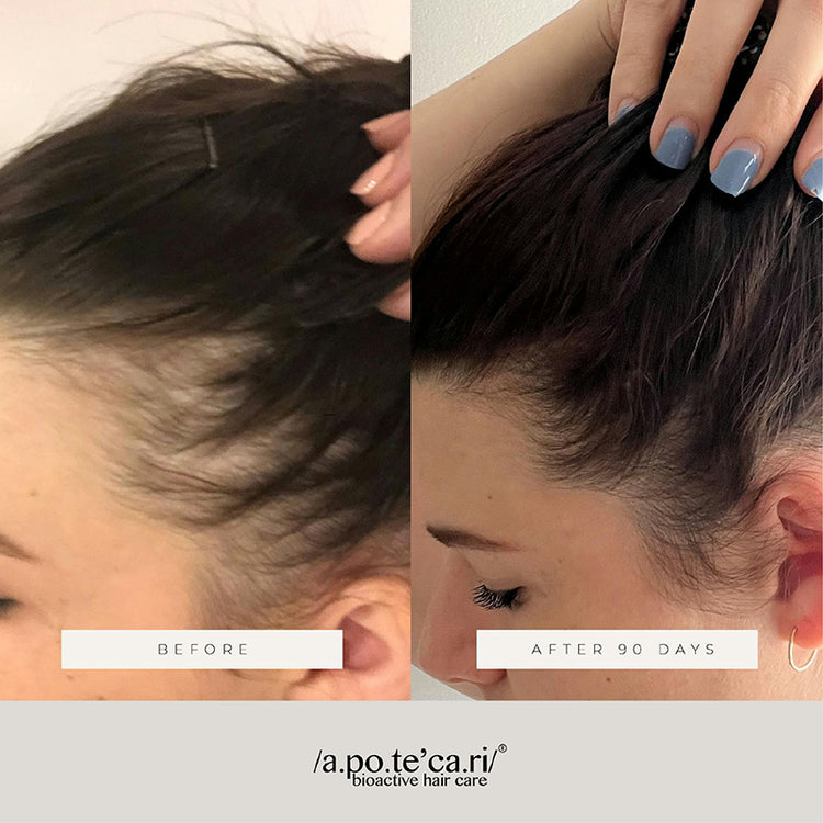 Apotecari Mane Event 90 Day Kit