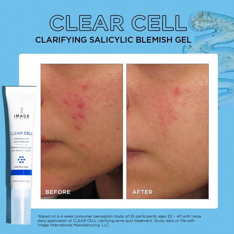 Image Clear Cell Clarifying Salicylic Blemish Gel 15ml