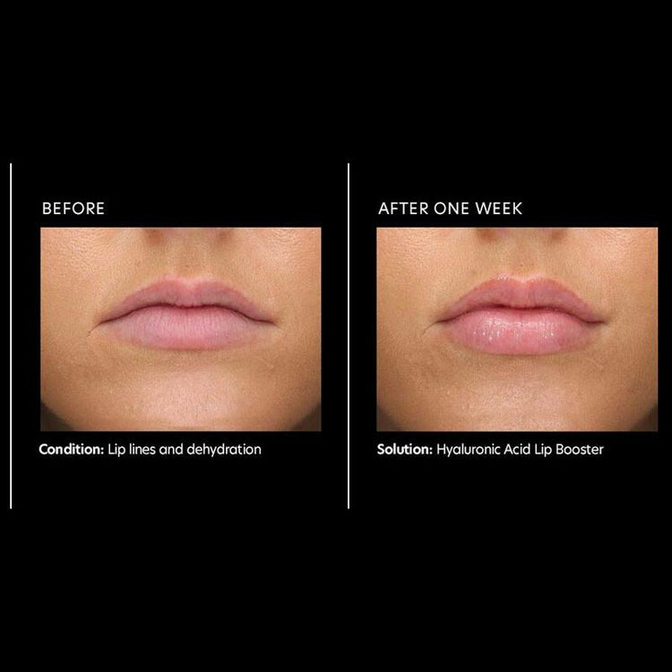 PCA Skin Hyaluronic Acid Lip Booster 6g