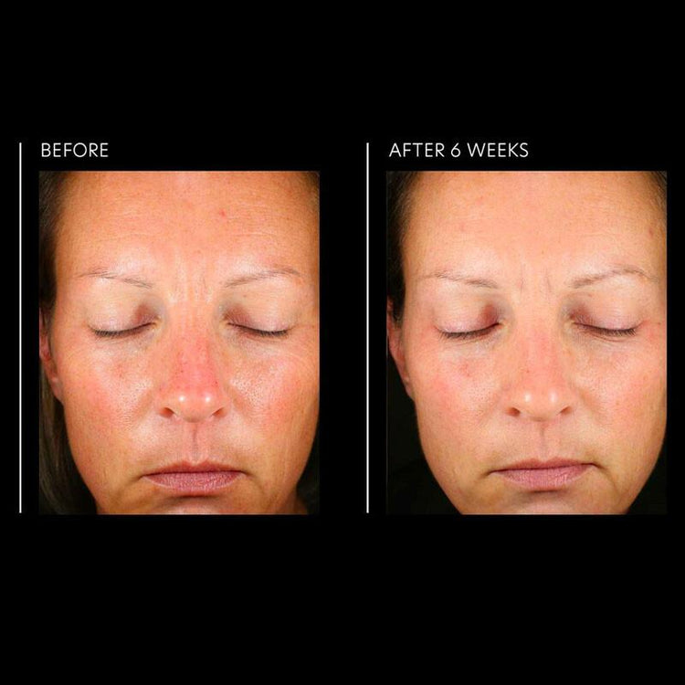 PCA Skin Hyaluronic Acid Overnight Mask 50ml